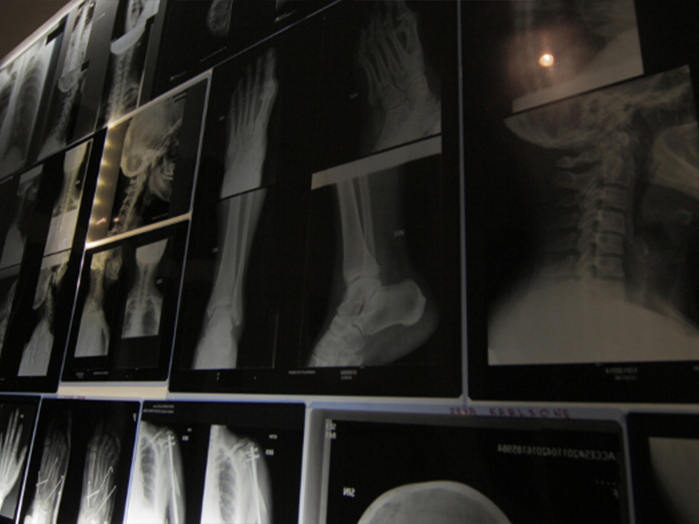 Escape room Amnesia - photo 3/7